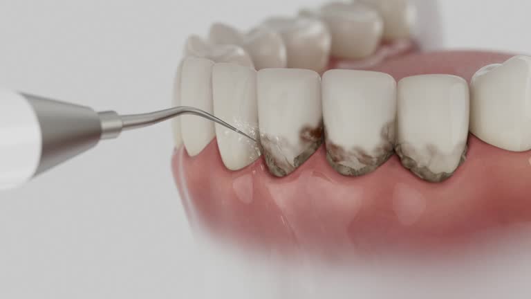 Reliable Emergency Dentist contractor in Barton, NM by Smile Center Dentistry